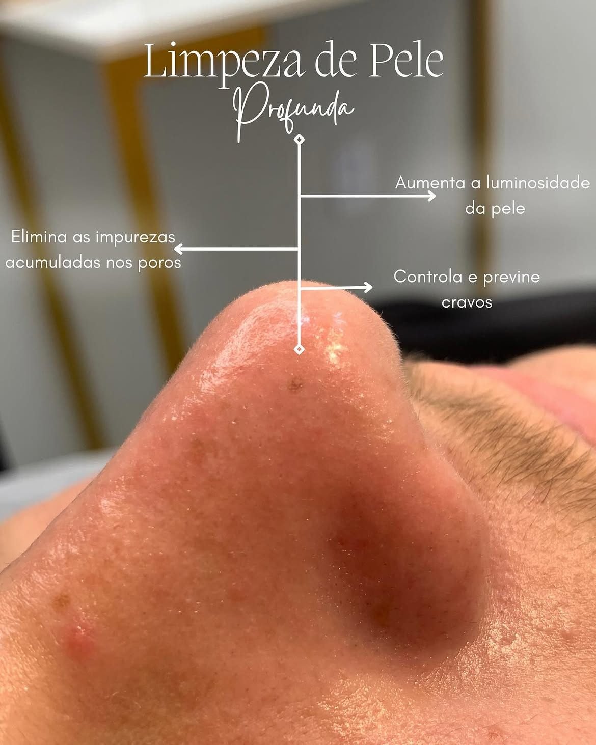 Limpeza de pele profunda
